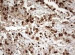 Ki67 Antibody in Immunohistochemistry (Paraffin) (IHC (P))
