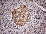 Ki67 Antibody in Immunohistochemistry (Paraffin) (IHC (P))
