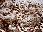 Ki67 Antibody in Immunohistochemistry (Paraffin) (IHC (P))