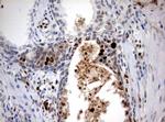 Ki67 Antibody in Immunohistochemistry (Paraffin) (IHC (P))