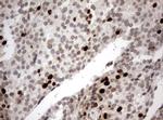 Ki67 Antibody in Immunohistochemistry (Paraffin) (IHC (P))