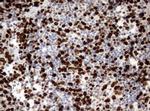 Ki67 Antibody in Immunohistochemistry (Paraffin) (IHC (P))
