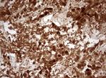 Ki67 Antibody in Immunohistochemistry (Paraffin) (IHC (P))