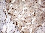 Ki67 Antibody in Immunohistochemistry (Paraffin) (IHC (P))
