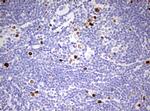 Ki67 Antibody in Immunohistochemistry (Paraffin) (IHC (P))