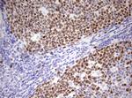 Ki67 Antibody in Immunohistochemistry (Paraffin) (IHC (P))