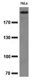 Ki67 Antibody in Western Blot (WB)