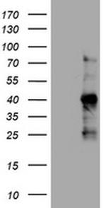 Ki67 Antibody in Western Blot (WB)
