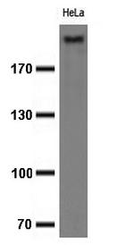 Ki67 Antibody in Western Blot (WB)