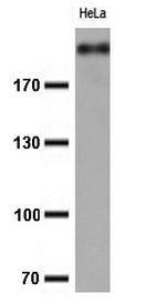 Ki67 Antibody in Western Blot (WB)