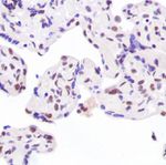 Ku80 Antibody in Immunohistochemistry (IHC)