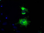 L1CAM Antibody in Immunocytochemistry (ICC/IF)