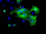 L1CAM Antibody in Immunocytochemistry (ICC/IF)
