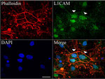 L1CAM Antibody in Immunocytochemistry (ICC/IF)