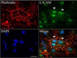 L1CAM Antibody in Immunocytochemistry (ICC/IF)