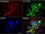 L1CAM Antibody in Immunocytochemistry (ICC/IF)