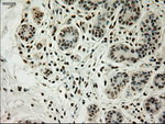 L1CAM Antibody in Immunohistochemistry (Paraffin) (IHC (P))