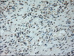 L1CAM Antibody in Immunohistochemistry (Paraffin) (IHC (P))