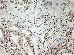 L1CAM Antibody in Immunohistochemistry (Paraffin) (IHC (P))