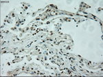 L1CAM Antibody in Immunohistochemistry (Paraffin) (IHC (P))