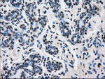 L1CAM Antibody in Immunohistochemistry (Paraffin) (IHC (P))