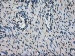 L1CAM Antibody in Immunohistochemistry (Paraffin) (IHC (P))