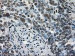 L1CAM Antibody in Immunohistochemistry (Paraffin) (IHC (P))