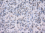 L1CAM Antibody in Immunohistochemistry (Paraffin) (IHC (P))