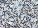 L1CAM Antibody in Immunohistochemistry (Paraffin) (IHC (P))