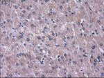 L1CAM Antibody in Immunohistochemistry (Paraffin) (IHC (P))
