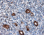 L1CAM Antibody in Immunohistochemistry (Paraffin) (IHC (P))