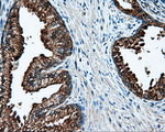 L1CAM Antibody in Immunohistochemistry (Paraffin) (IHC (P))