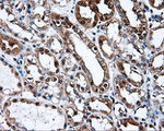 L1CAM Antibody in Immunohistochemistry (Paraffin) (IHC (P))