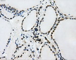 L1CAM Antibody in Immunohistochemistry (Paraffin) (IHC (P))