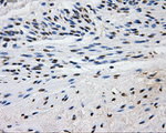 L1CAM Antibody in Immunohistochemistry (Paraffin) (IHC (P))