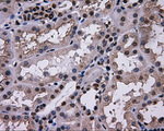 L1CAM Antibody in Immunohistochemistry (Paraffin) (IHC (P))