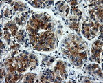 L1CAM Antibody in Immunohistochemistry (Paraffin) (IHC (P))