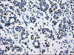 L1CAM Antibody in Immunohistochemistry (Paraffin) (IHC (P))