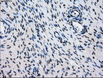L1CAM Antibody in Immunohistochemistry (Paraffin) (IHC (P))