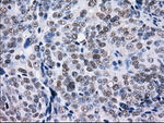 L1CAM Antibody in Immunohistochemistry (Paraffin) (IHC (P))