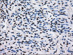 L1CAM Antibody in Immunohistochemistry (Paraffin) (IHC (P))