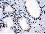 L1CAM Antibody in Immunohistochemistry (Paraffin) (IHC (P))