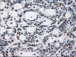 L1CAM Antibody in Immunohistochemistry (Paraffin) (IHC (P))