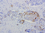 L1CAM Antibody in Immunohistochemistry (Paraffin) (IHC (P))