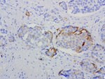 L1CAM Antibody in Immunohistochemistry (Paraffin) (IHC (P))