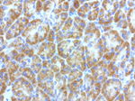 L1CAM Antibody in Immunohistochemistry (Paraffin) (IHC (P))