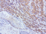 L1CAM Antibody in Immunohistochemistry (Paraffin) (IHC (P))
