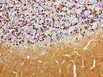 L1CAM Antibody in Immunohistochemistry (Paraffin) (IHC (P))