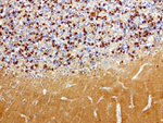 L1CAM Antibody in Immunohistochemistry (Paraffin) (IHC (P))