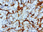 L1CAM Antibody in Immunohistochemistry (Paraffin) (IHC (P))
